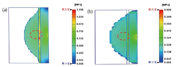 圖2 : Von Mises應力分佈 (a) 白斑嚴重組別 (b) 白斑輕微組別
