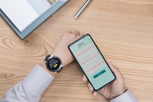 华硕VivoWatch智慧健康表系列的ECG APP ，能够建立、纪录、储存、传送与显示第一导程(Lead I)相似的单通道心电图。