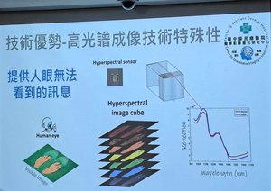 高光譜成像技術透過光的波長、能量及影像突破視覺限制，可在臨床上應用分析評估不同等級的風險及罹病機率。（source：台中榮總）